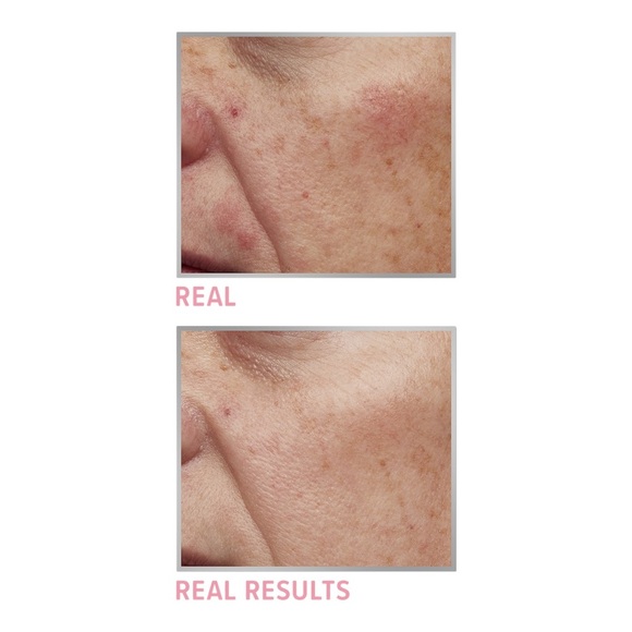 IT Cosmetics Bye Bye Redness Neutralizing Color-Correcting Concealer (3 shades) - Picture 7 of 7